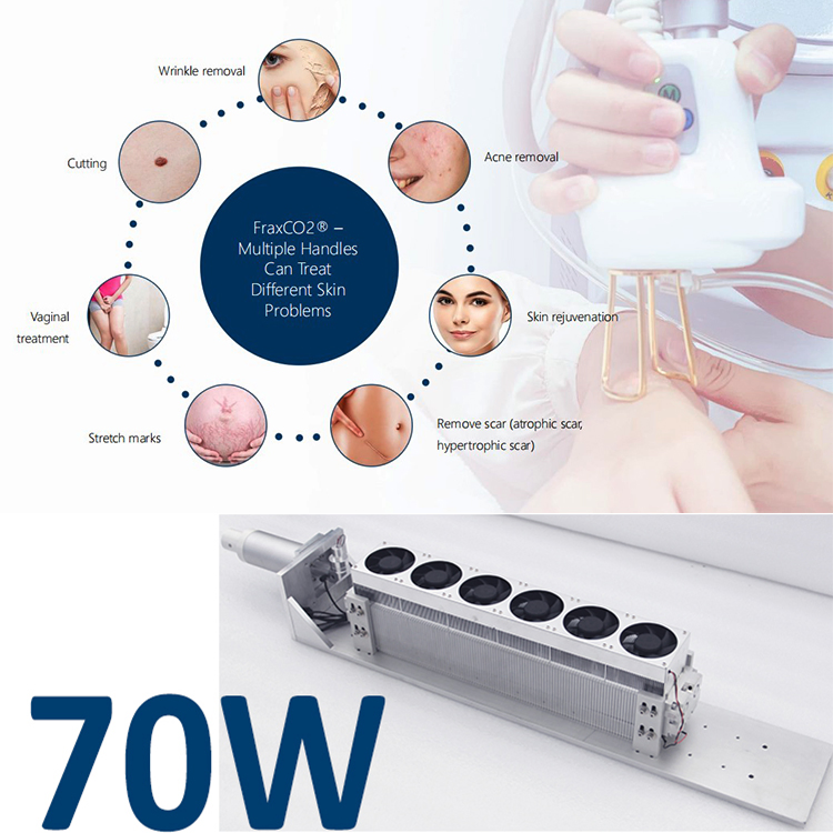 Fractional CO2 Laser Skin Resurfacing Machine CO2 Fractional Laser Stretch Mark Removal Machine