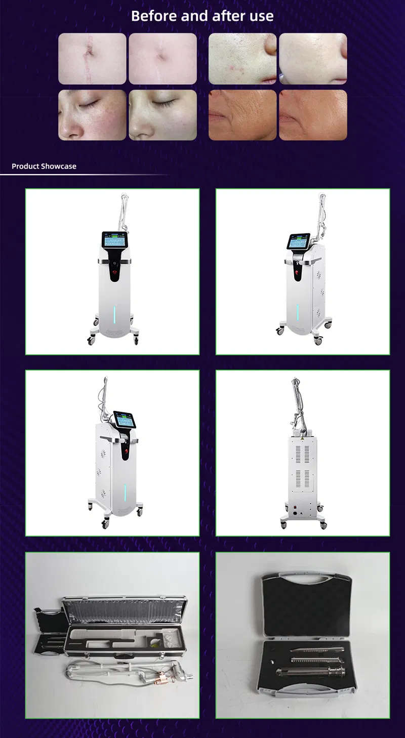 Treatment Heads Detail