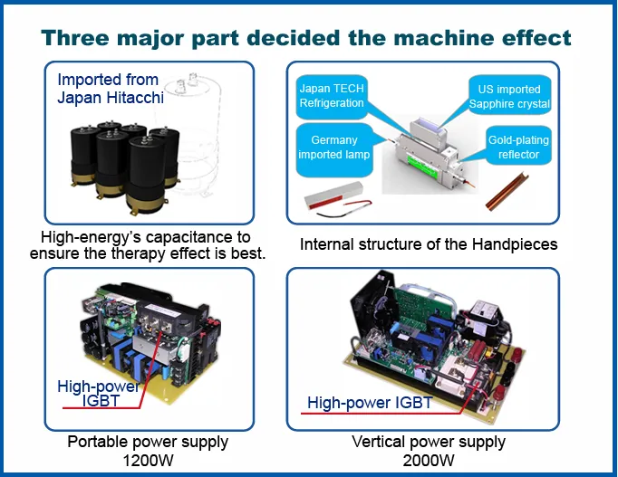 IPL Machine Advantages