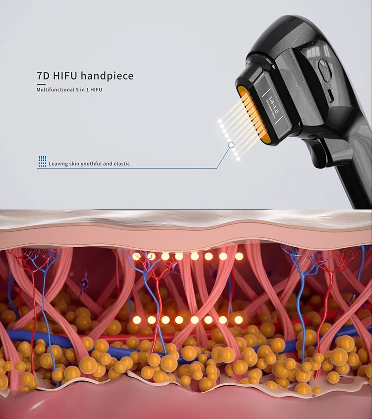 Liposonix Technology