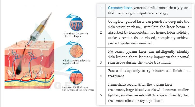Vascular Removal Treatment