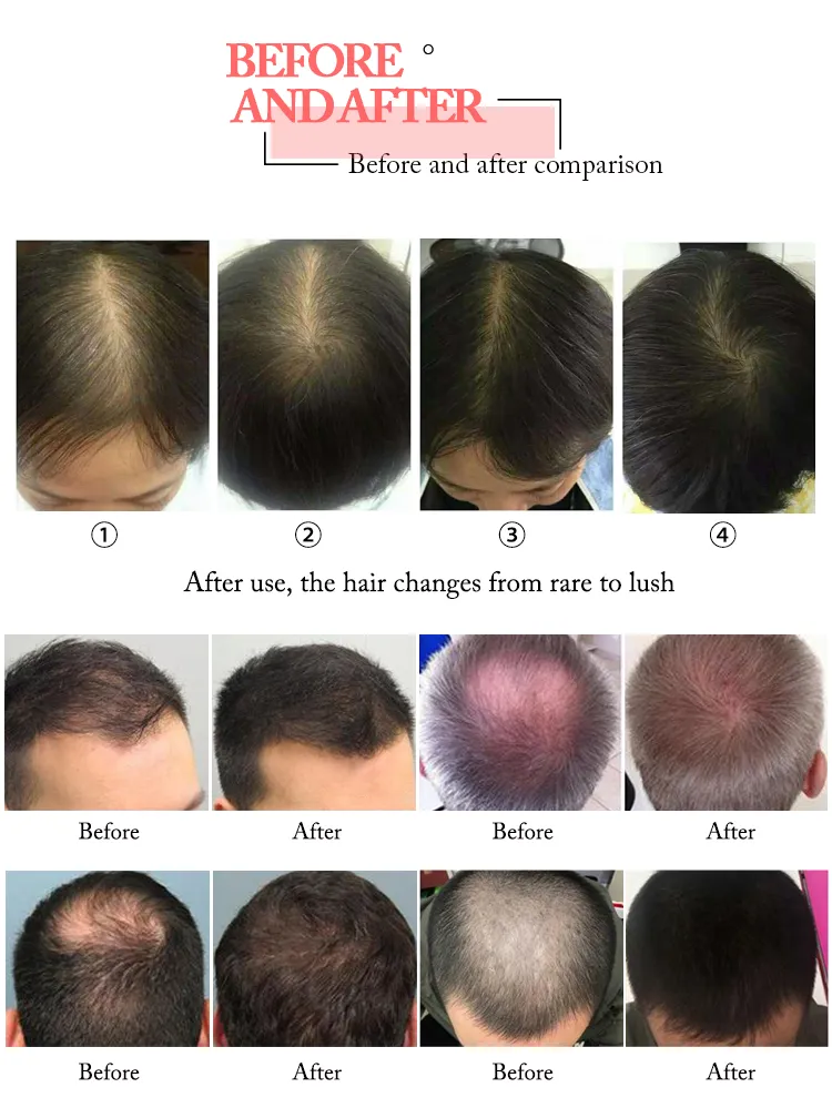 Hair Regrowth Process 1