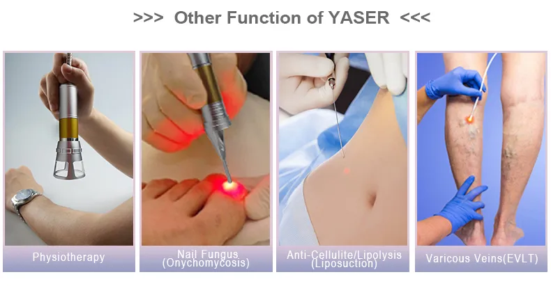 Vascular Removal Treatment
