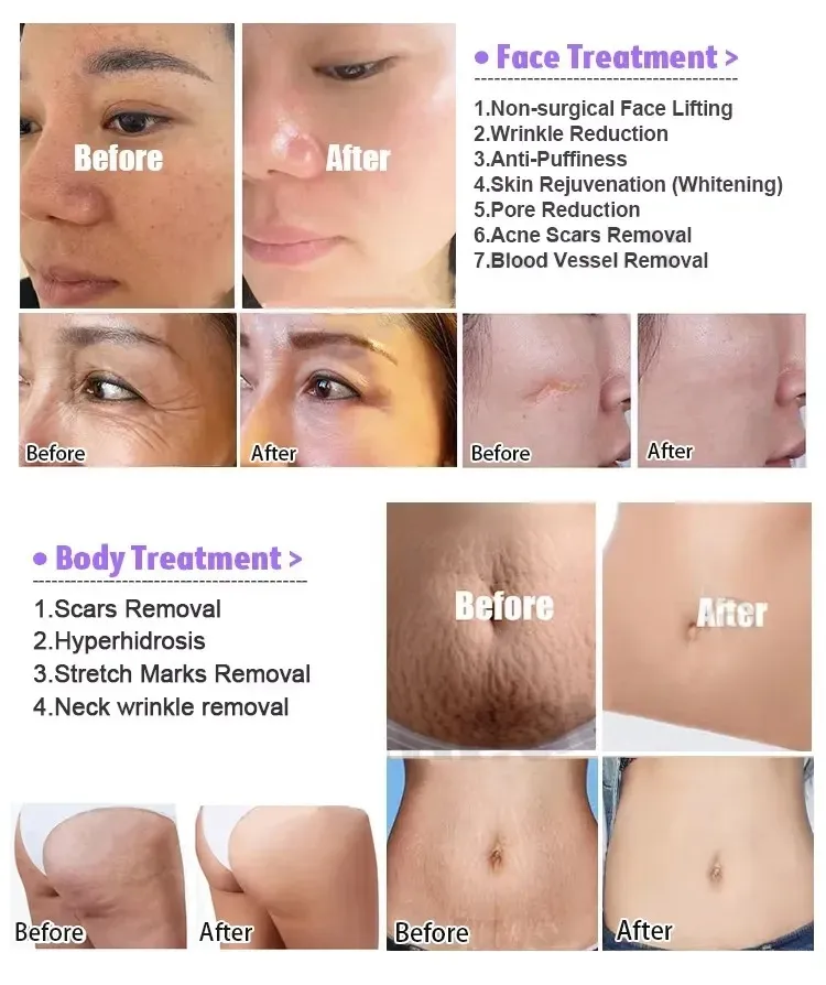 Before and After Results