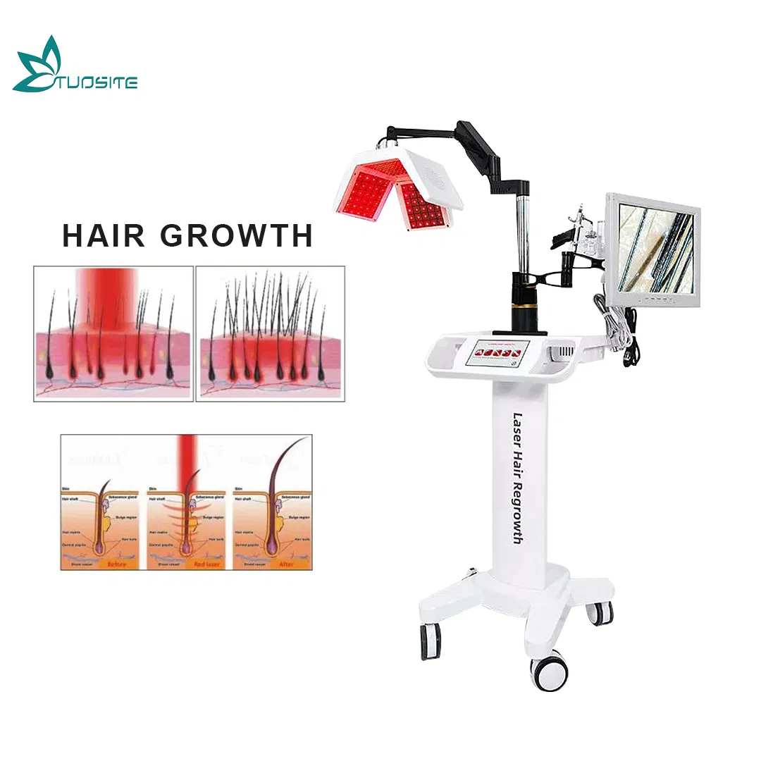 Professional Anti Hair Loss Treatment Diode Laser Hair Regrowth Machine