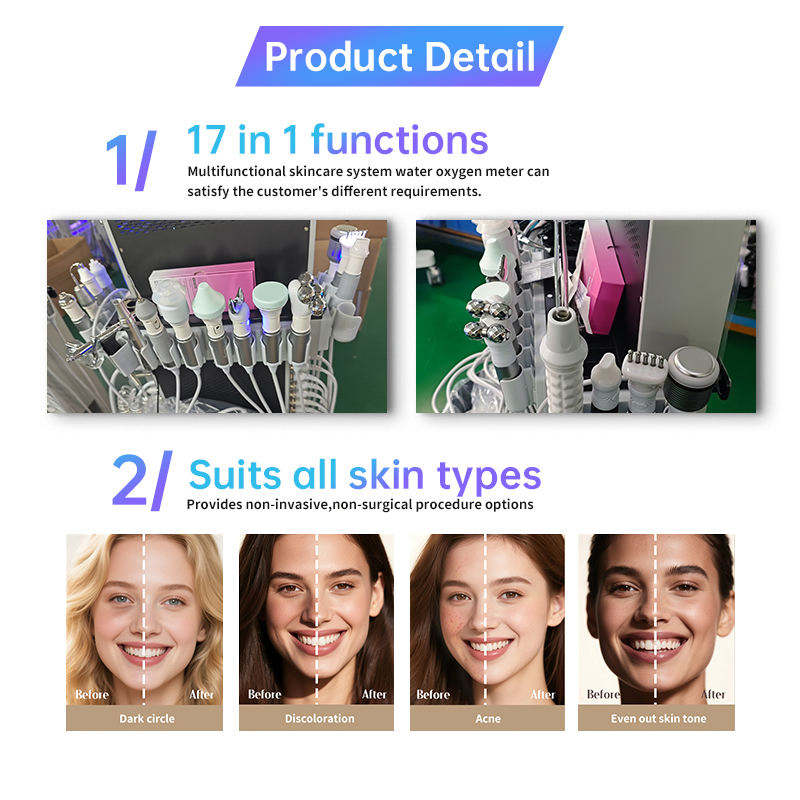 17in1 Hydro Skin Hidra Beauty Facial Oxygen Dermabrasion Systems Facial Microdermabrasion Machine