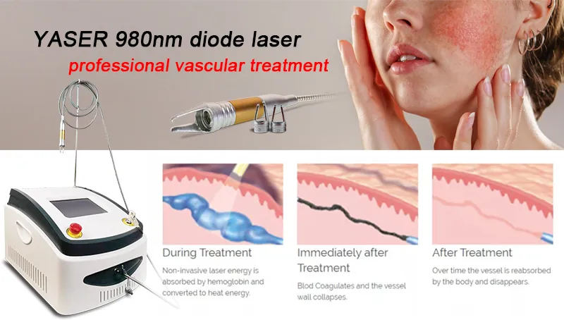 Diode Laser 980nm Device