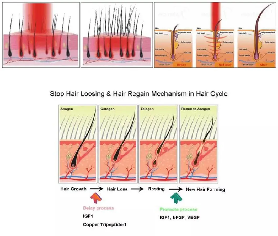 Hair Loss Treatment Device