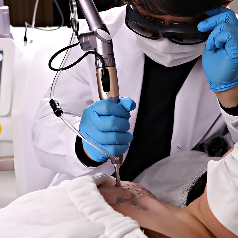 High Power 2025 Pico Tattoo Removal Picosecond Laser Machine for Salons