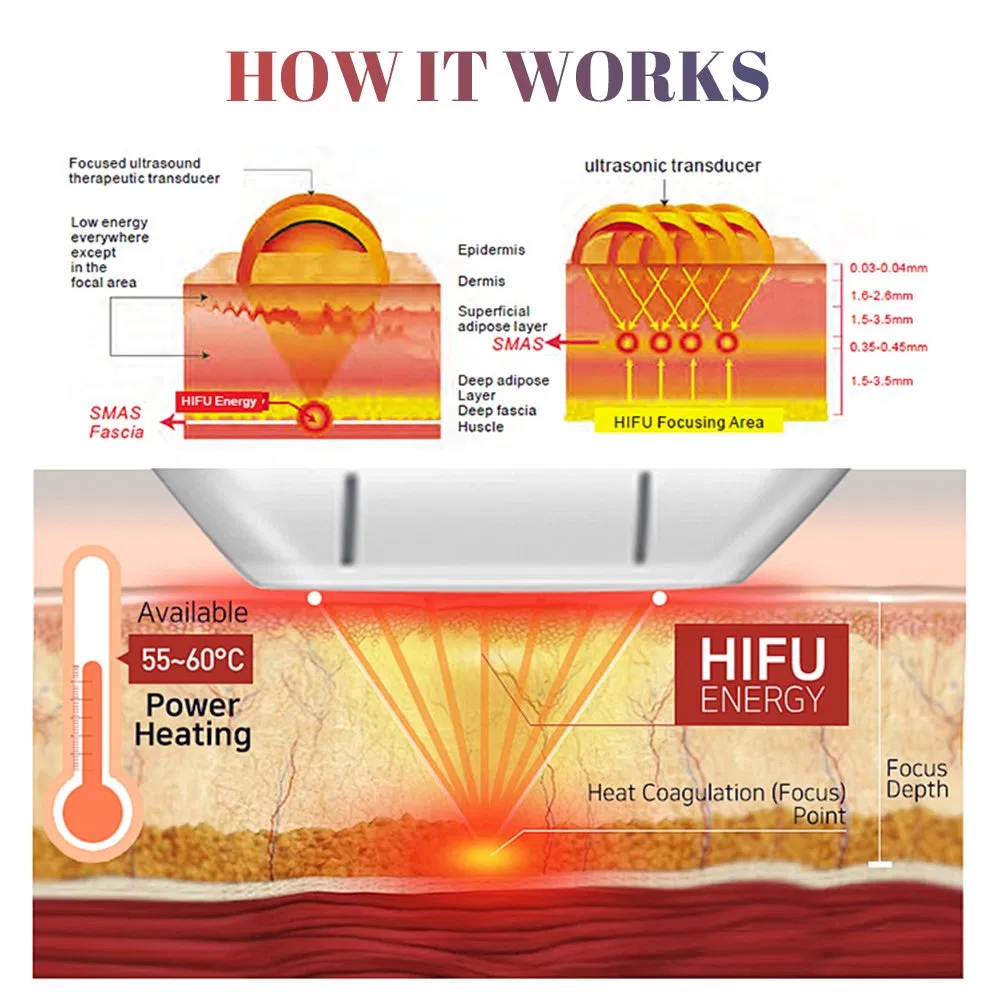 Hifu Machine High Intensity Focused Ultrasound Vaginal Tightening Improve Sexual Life Weight Loss Face Lifting 5D 7D Hifu
