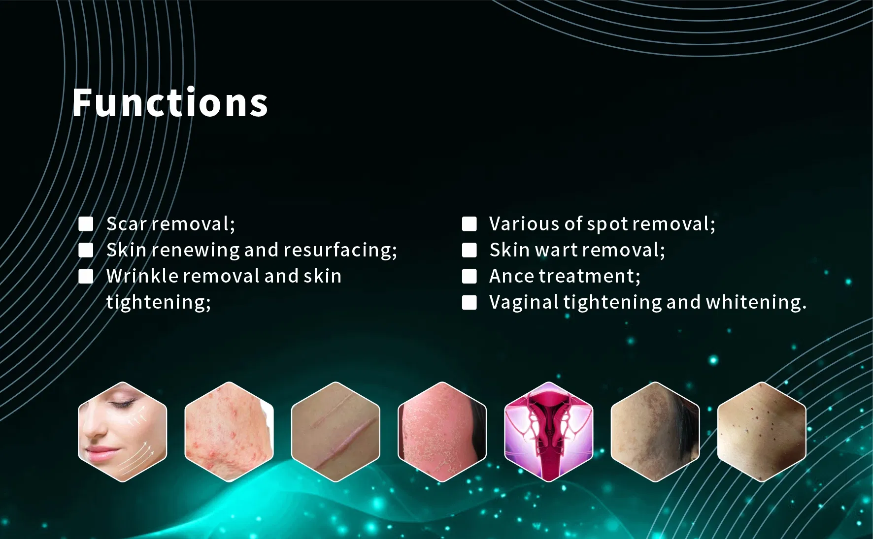 Skin Tightening Technology