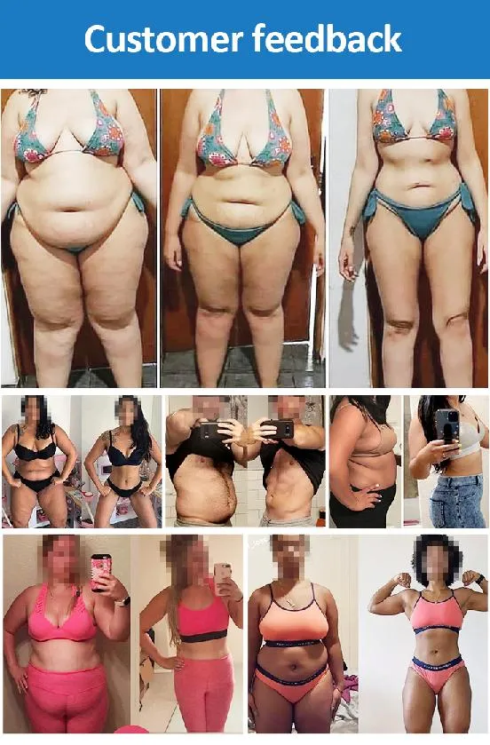 Body Contouring Treatment