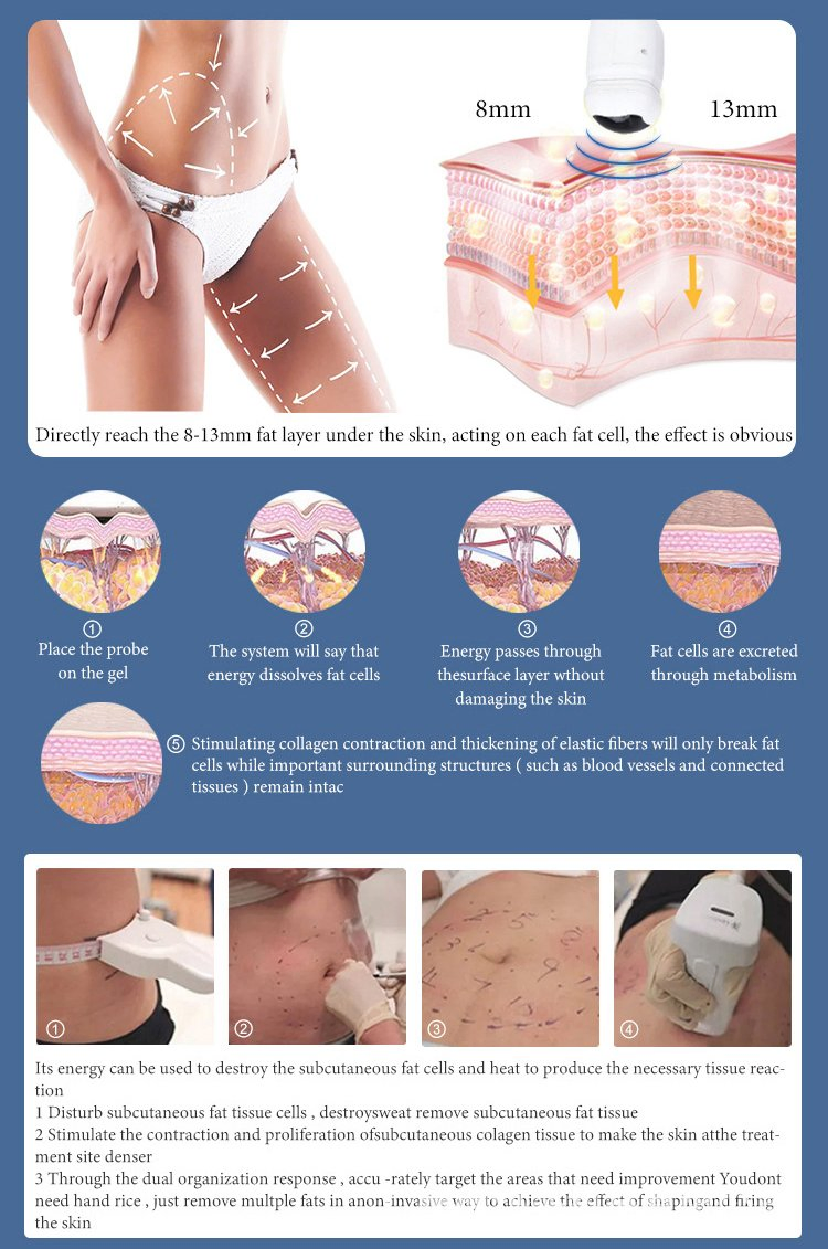 12 Lines V Max Mini Hifu Cartridges Corporal Smas High Intensity Focused Ultrasound Vmax Ultra Face Liposonix 7D Hifu