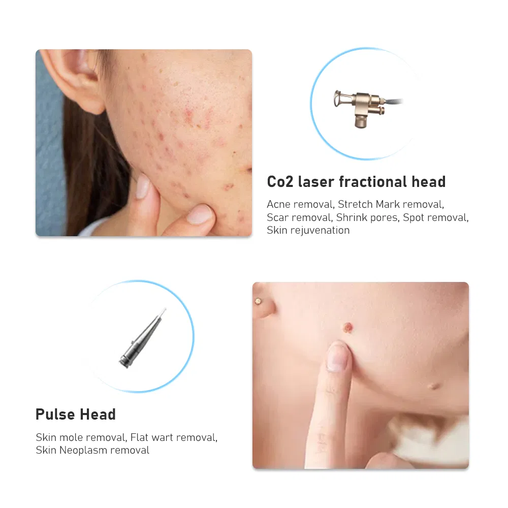 Portable 3 in 1 Vaginal Rejuvenation Care Skin Resurfacing Beauty Equipment SPA Scars Removal Tightening CO2 Fractional Laser Machine for Sale