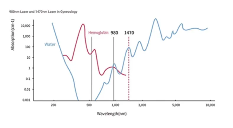 Laser Technology Illustration