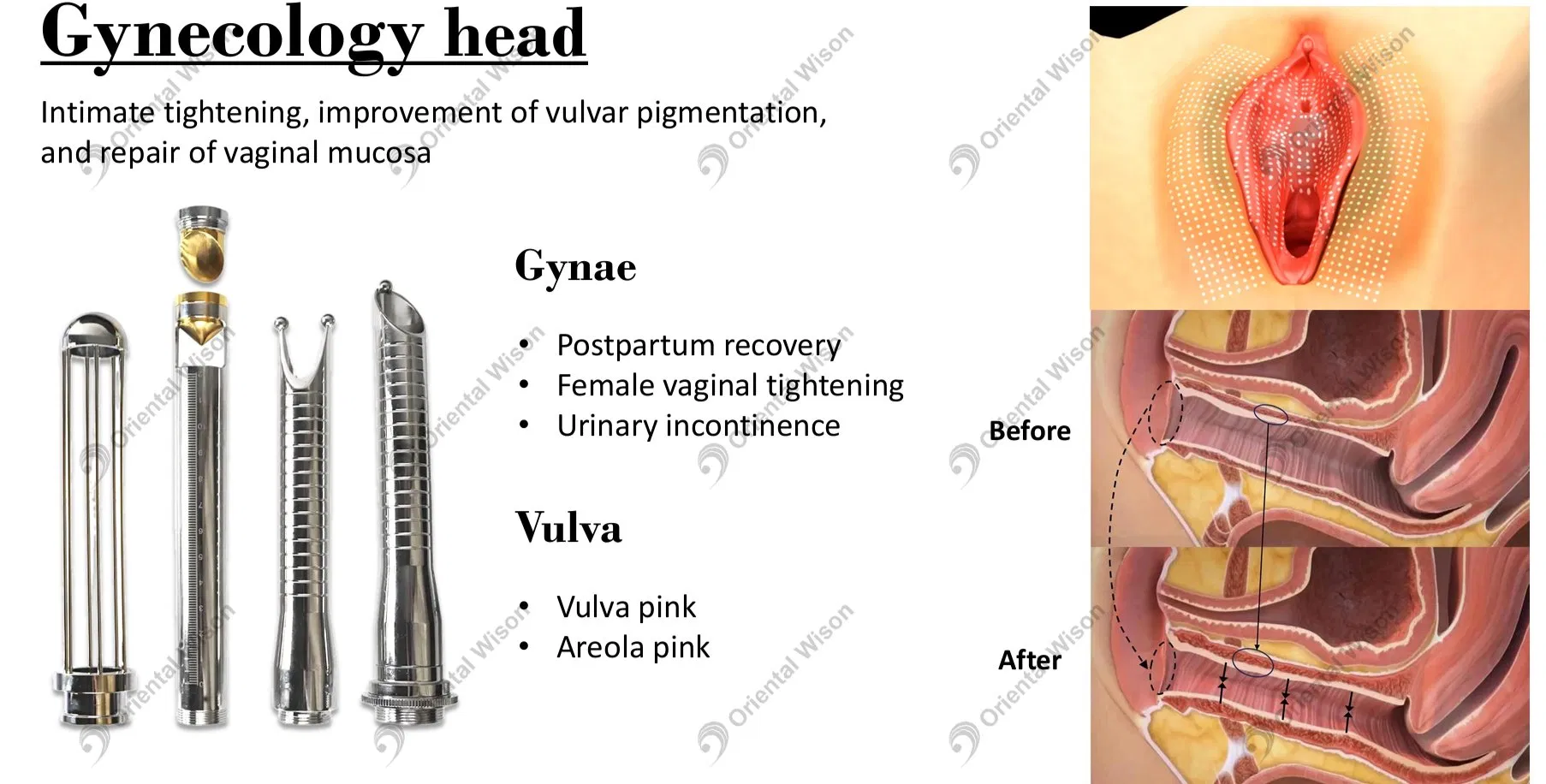 Gynecology Principle