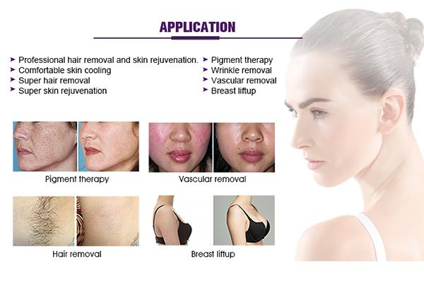 2026 New High Power 60W 980nm Diode Laser Evlt Vascular Lesion Therapy Device Removal Vascular Removal