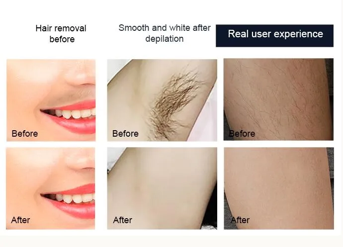 Before and After Treatment Results