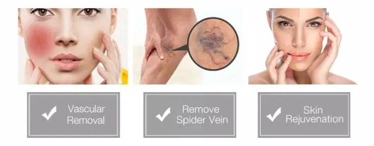 Application Treatment