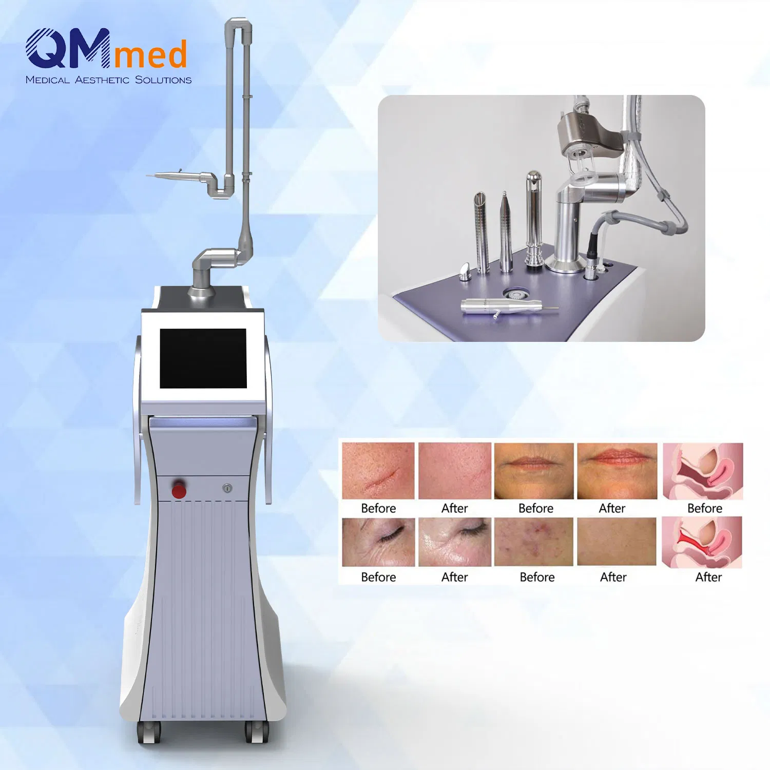 Top Selling Qm Medical CO2 Fractional Laser 10600nm Skin Rejuvenation Wrinkle Removal Skin Tightening Machine Vaginal Tightening Technology