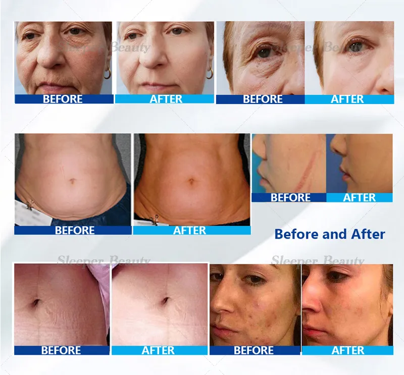 Professional Packaging