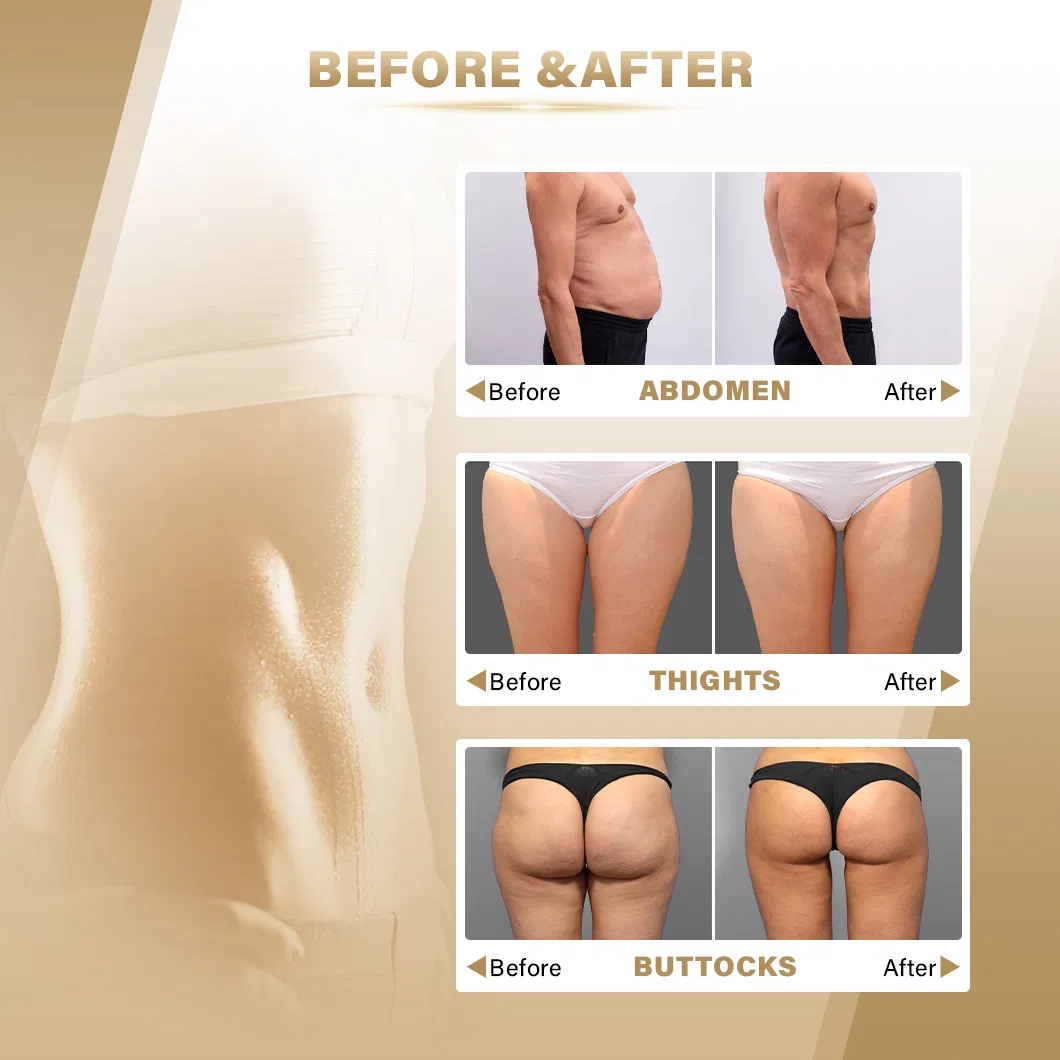 Before and After Results