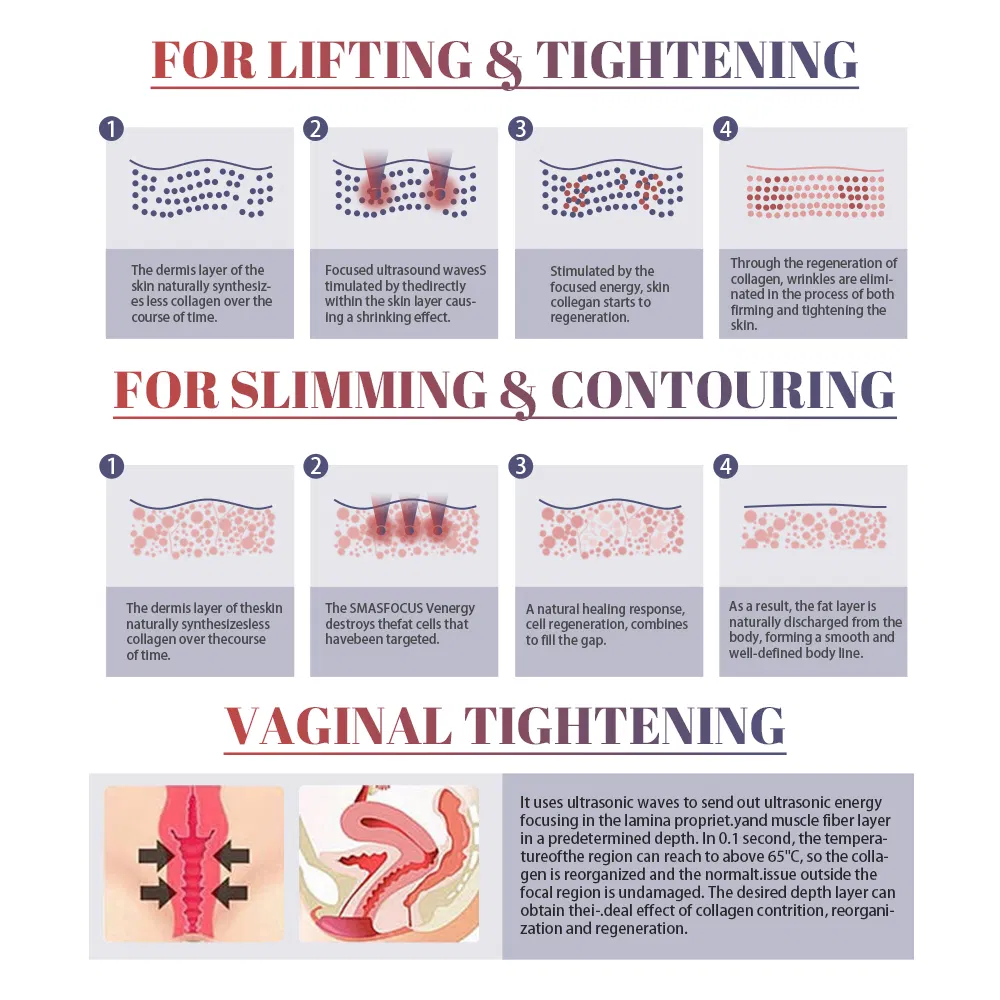 Hifu Machine High Intensity Focused Ultrasound Vaginal Tightening Improve Sexual Life Weight Loss Face Lifting 5D 7D Hifu