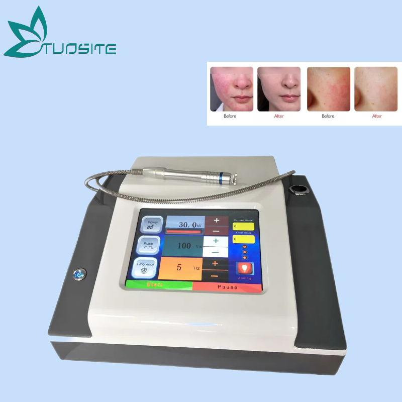 Laser Diode 980nm Laser Vascular Removal for Aesthetic Center Use