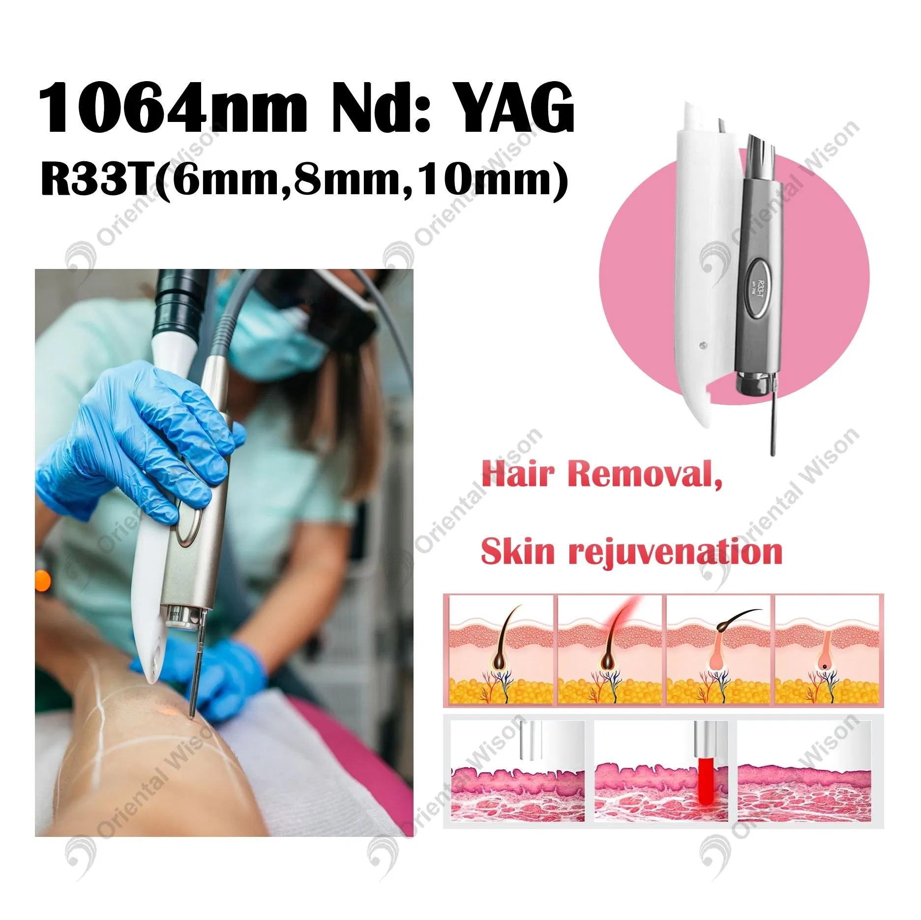 The Most Popular Fractional Skin Resurfacing Smooth Technology for Non-Surgical Vaginal Rejuvenation and Wellness Collagen Stimulation Multi-Layer Treatment