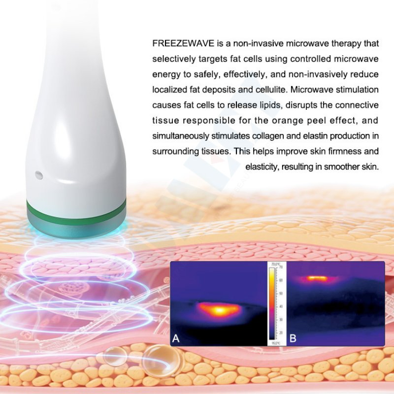 Non Invasive Cold Wave Body Contouring Machine for Professional Slimming Clinics