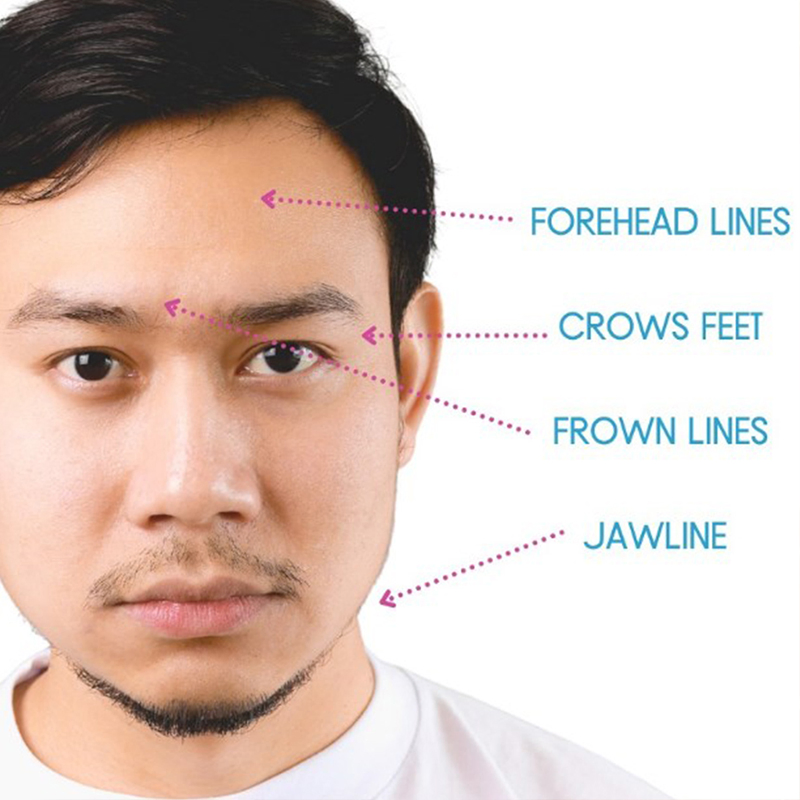 Non-Invasive Solution for Lifting and Contouring Dermal Filler Face Neck Hands Body Plla Inject