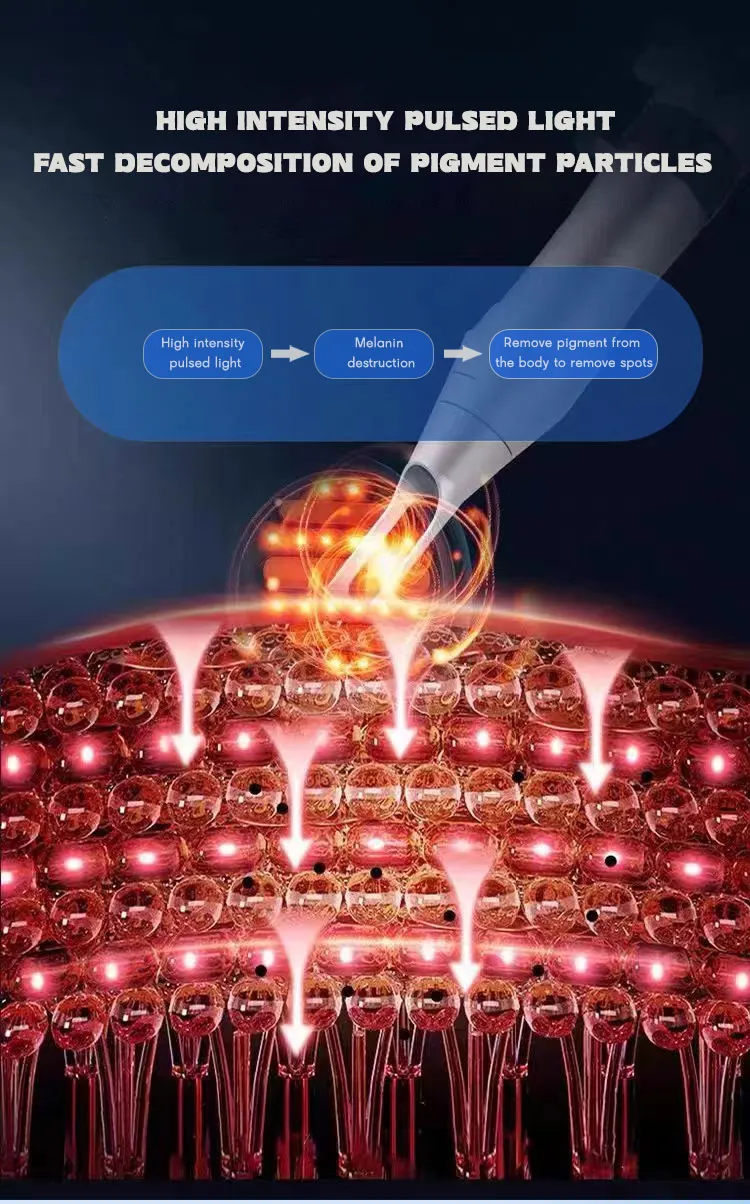 Before and After Results