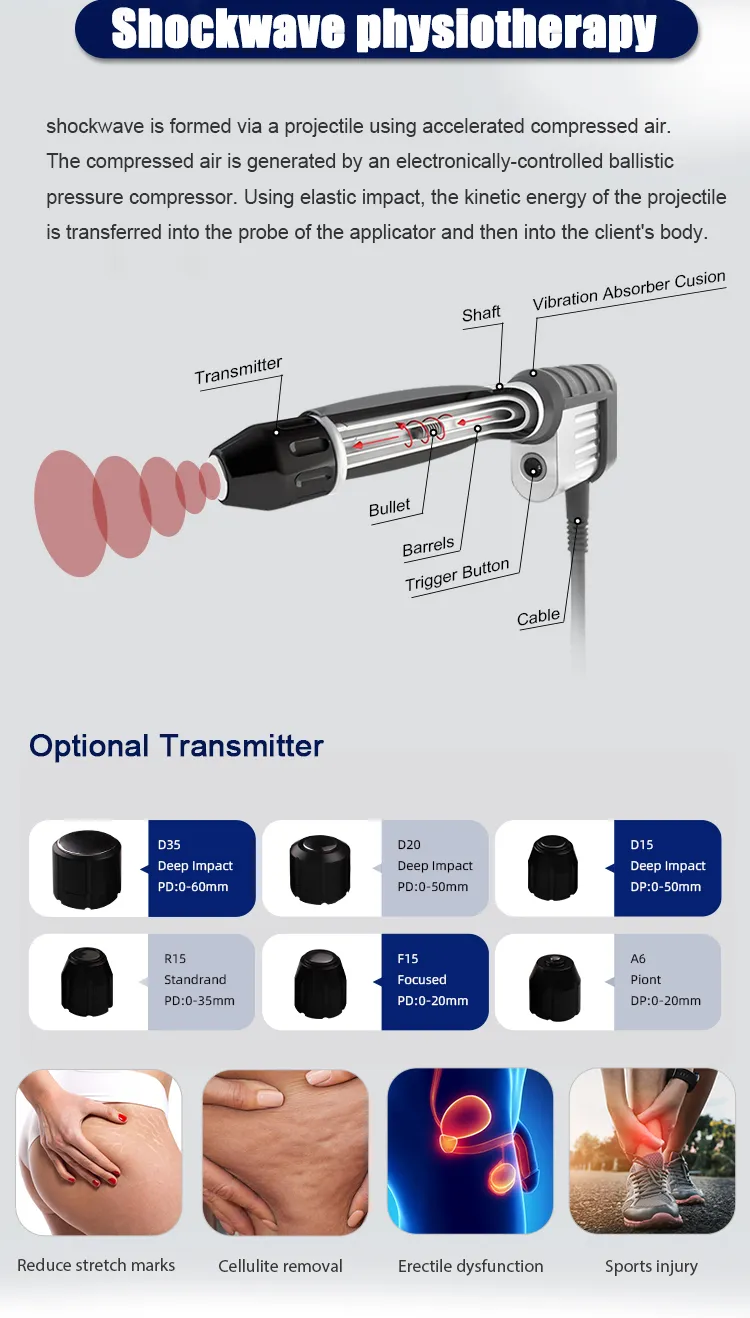 Shockwave Features 1