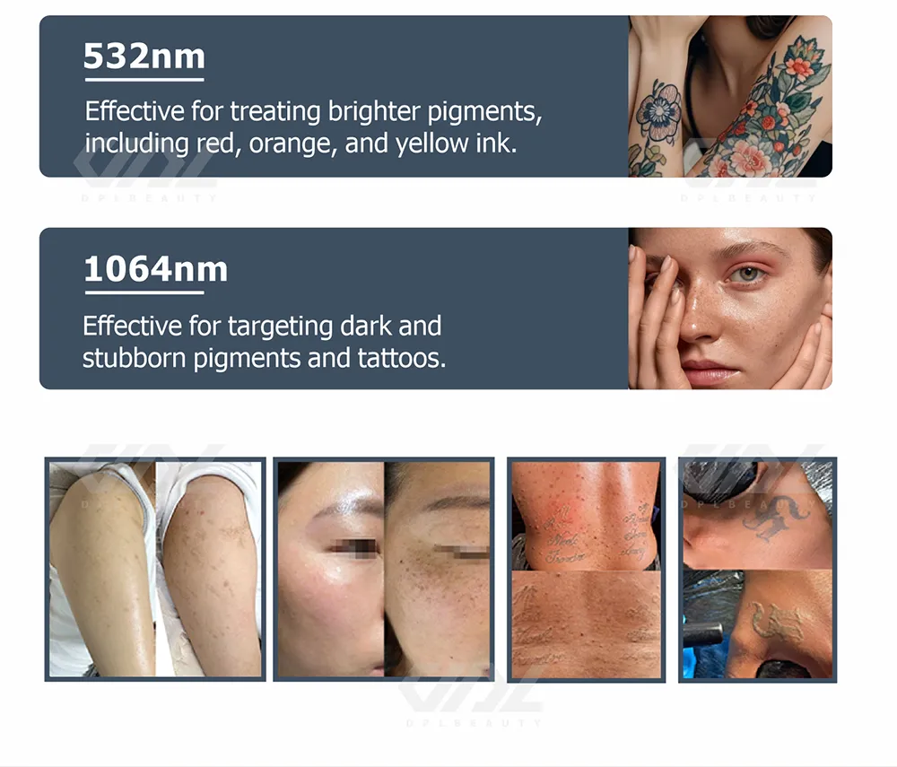 Pico Laser Machine 5