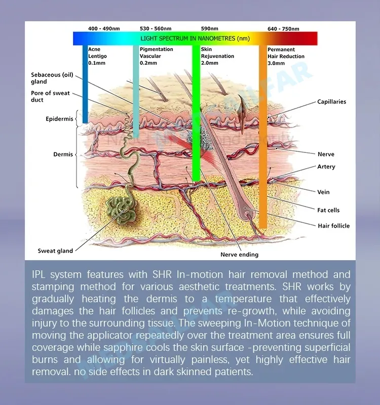 IPL Working Principle