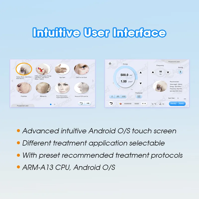Interface Advantages