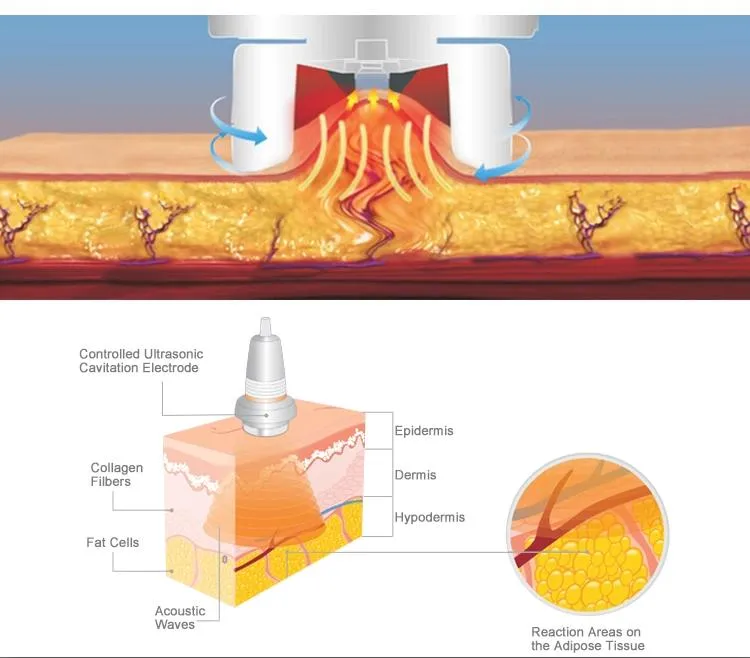 Inner Ball Roller Tech 2