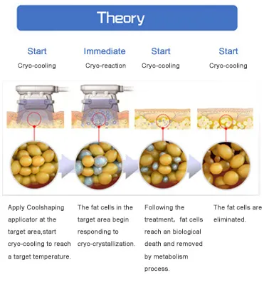 Treatment Theory