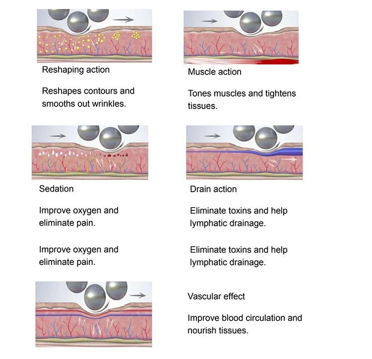 Inner Ball Roller Tech 1