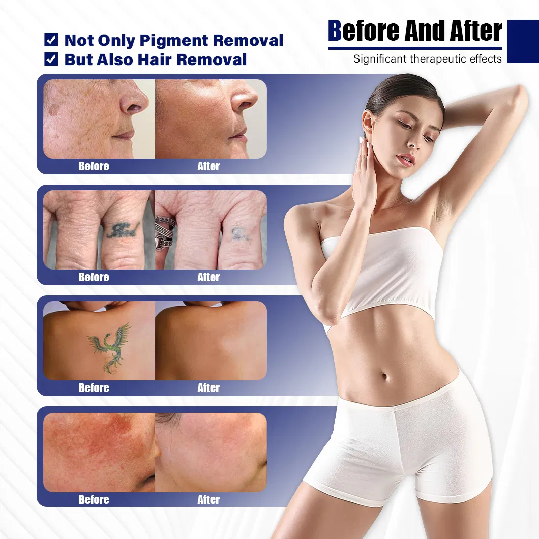 Before and After Results