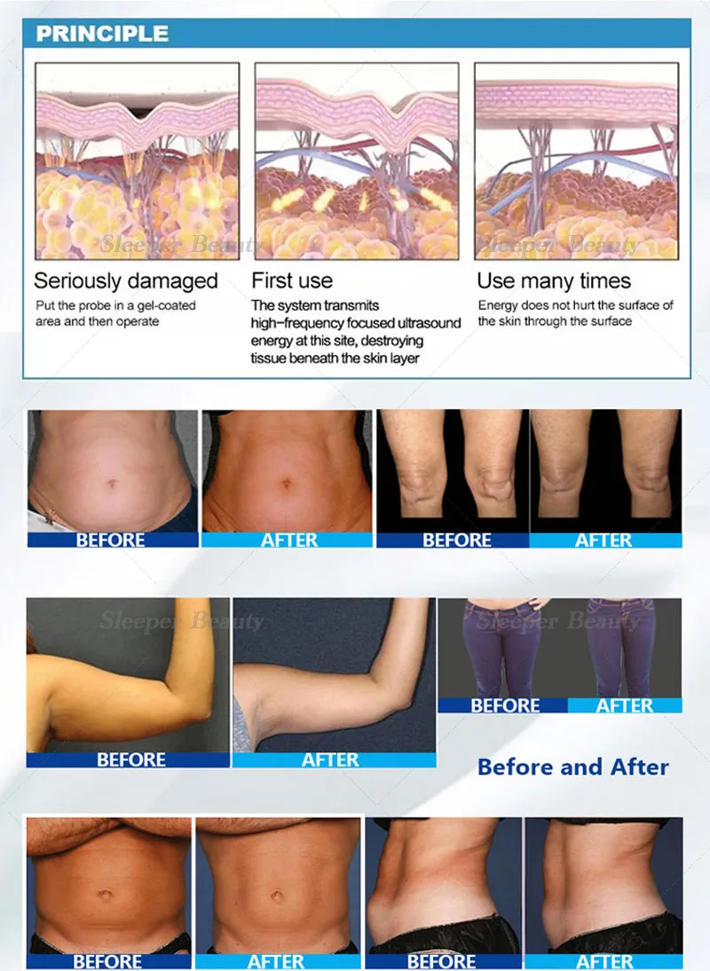 Handle Specifications
