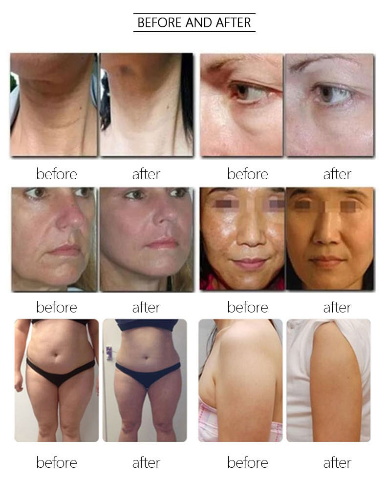 High Intensity Focused Ultrasound 7D Hifu Machine Beauty Equipment Skin Lifting Machine Professional Beauty Slimming Machine