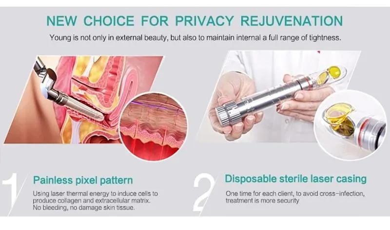 Vaginal Treatment System