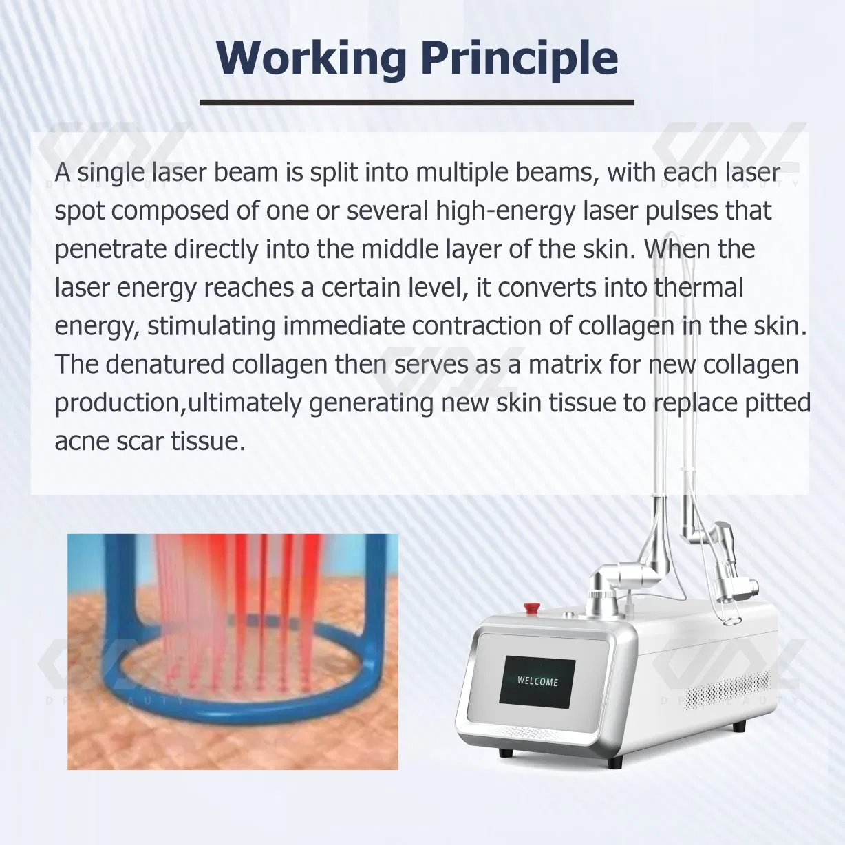 Portable CO2 Fractional Laser Scar Removal Machine Factory Price Wrinkle Removal Machine Skin Resurfacing