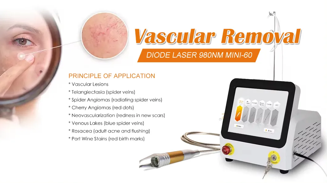 Vascular Removal Machine