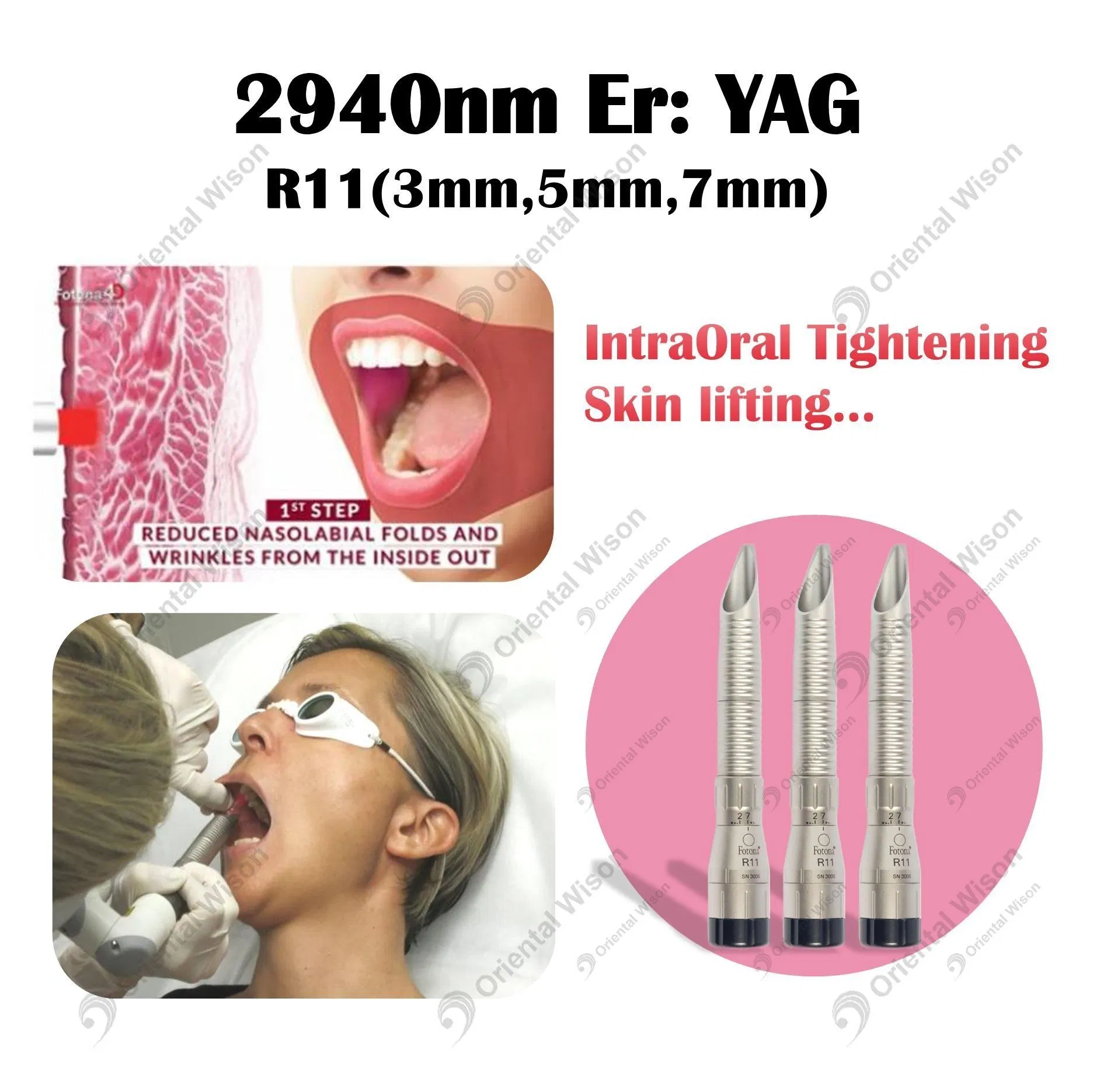 Erbium 2940nm Fractional Laser Vaginal Rejuvenation ND YAG Laser 10600nm Machine Laser Hair Removal
