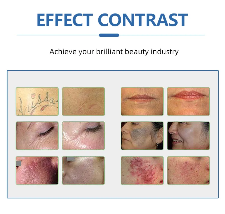 Before and After Results