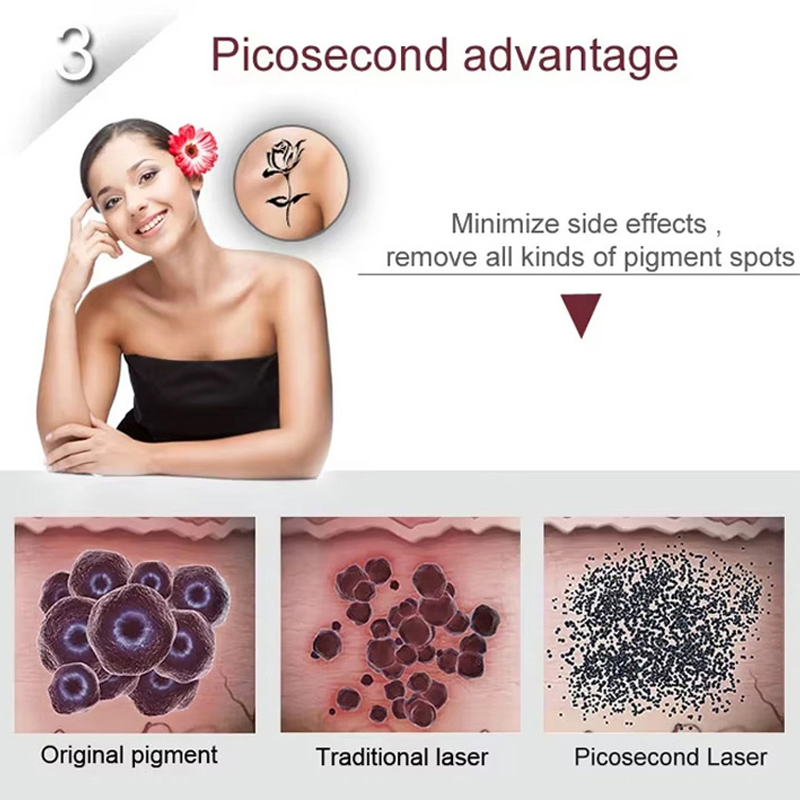 Professional Picosecond Pico Laser Tattoo Machine Eyebrow Blackhead Removal Pico ND YAG Laser Pigment Acne Scar Skin Tightening Whitening Rejuvenation Equipment