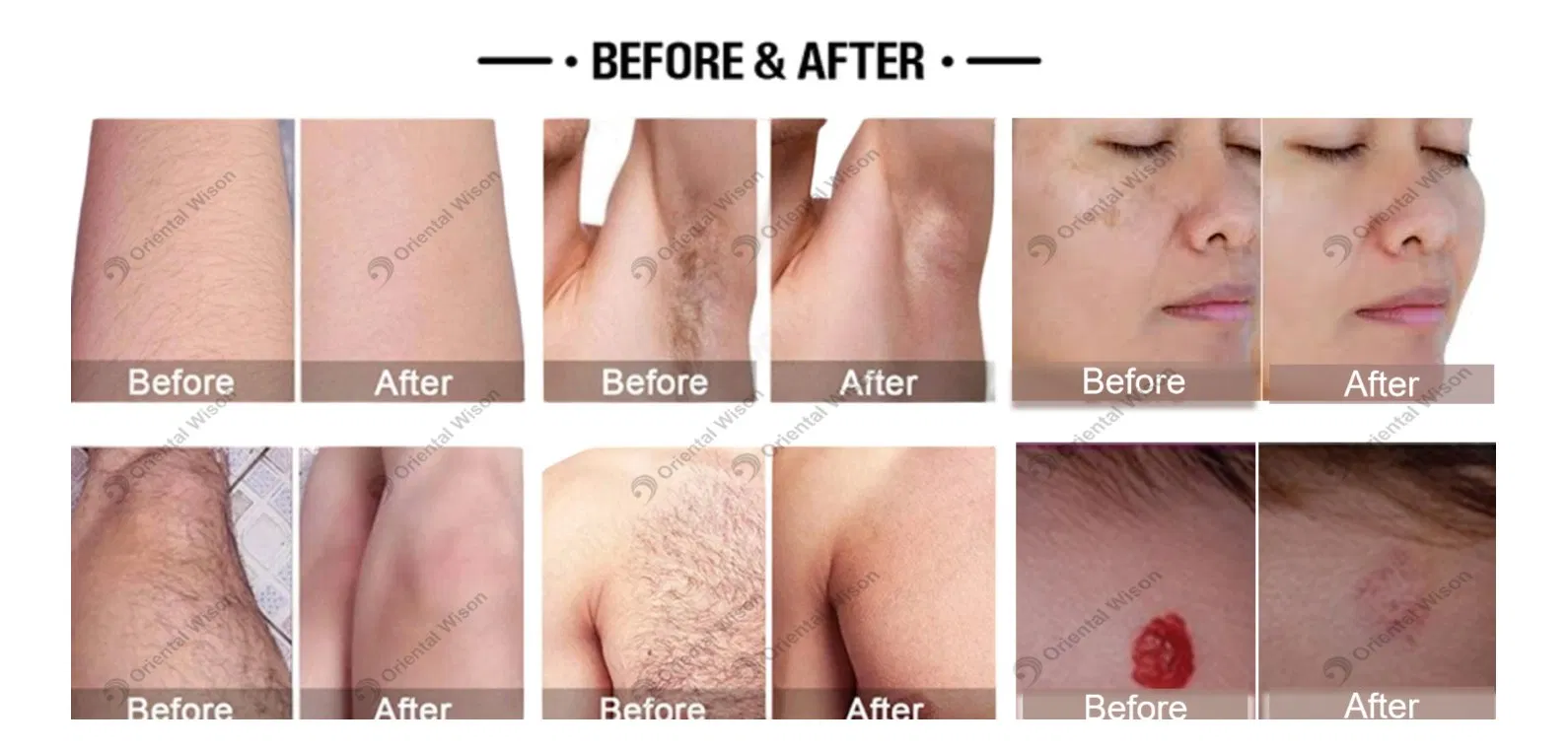 Before and After Results