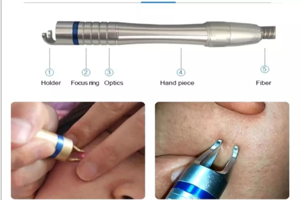 Factory Prices 980nm Diode Laser Vascular Therapy Machine Spider Veins Removal Skin Rejuvenation Laser Nail Fungus Therapy Device